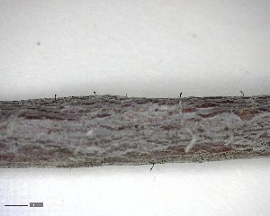  (Phaeocalicium compressulum - DLH-2017-647)  @11 [ ] CreativeCommons  Attribution Non-Commercial Share-Alike (2020) Diane L. Haughland Unspecified