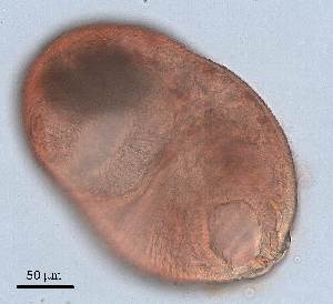  (Diphterostomum FC_sp 1 - DPDP-0026)  @11 [ ] No Rights Reserved (2014) Unspecified Unspecified