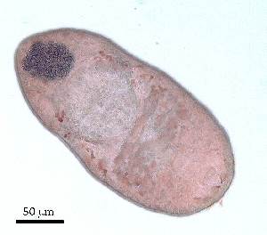  (Diphterostomum FC_sp 2 - DPDP-0031)  @11 [ ] No Rights Reserved (2014) Unspecified Unspecified