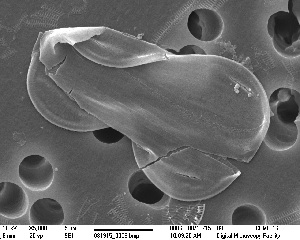  (Entomoneis sp. 1 - IK_CCMP_1692)  @11 [ ] CreativeCommons - Attribution Non-Commercial Share-Alike (2015) Jim Ehrman Mount Allison University