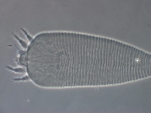  (Leipothrix n. sp - H92W-1)  @11 [ ] CreativeCommons - Attribution Non-Commercial Share-Alike (2020) Unspecified Nanjing Agriculture university