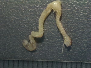  ( - 006_LC_4_12)  @11 [ ] CreativeCommons - Attribution Share-Alike (2025) Unspecified University of Aberdeen