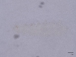  (Decapauropus vulgaris - Pau37)  @11 [ ] CreativeCommons  Attribution (by) (2032) Sylvia Schaeffer University of Graz, Institute of Biology