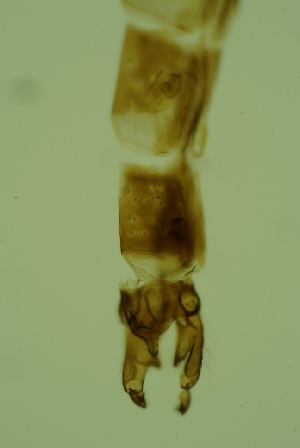  (Heleniella sp. 2ES - ZSM34342-C05)  @12 [ ] Unspecified (default): All Rights Reserved  SNSB, Staatliche Naturwissenschaftliche Sammlungen Bayerns ZSM (SNSB, Zoologische Staatssammlung Muenchen)