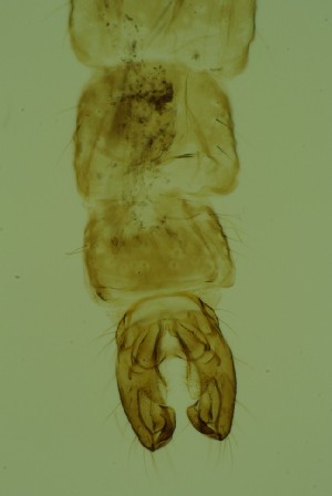  (Eukiefferiella cf. minor - ZSM34343-H05)  @11 [ ] Unspecified (default): All Rights Reserved  SNSB, Staatliche Naturwissenschaftliche Sammlungen Bayerns ZSM (SNSB, Zoologische Staatssammlung Muenchen)