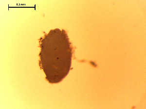  (Diplostomum sp. 7 SAL 2008 - D.H.Po.ABS.29.1)  @12 [ ] Copyright (2010) Sean Locke Environment Canada