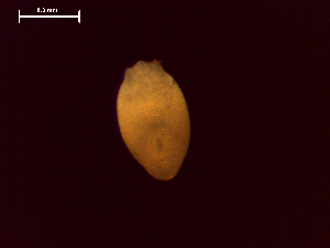  (Diplostomum sp. 7 - D.H.Po.ABS.30.1)  @12 [ ] Copyright (2010) Sean Locke Environment Canada