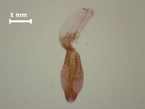  (Diplostomum sp. 4 SAL-2008 - D.IN.1.R.L50W.V30)  @13 [ ] Copyright (2010) Sean Locke Environment Canada