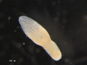  (Neodiplostomum travassossi - Nt.Bb.For.1501.D.1)  @11 [ ] CreativeCommons - Attribution (2014) Sean Locke Centre for Biodiversity Genomics