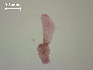  (Posthodiplostomum centrarchi - P.UIN.IH.Arhe1.1)  @14 [ ] Copyright (2010) Sean Locke Environment Canada
