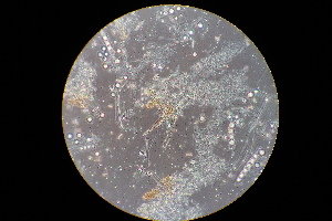  (Trichophaea scutelloides - GAJ.14885)  @11 [ ] CC BY-SA 4.0 (2001) Luomus University of Oulu