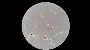  (Troposporella - GAJ.16616)  @11 [ ] by-nc (2023) Matti Kulju University of Oulu