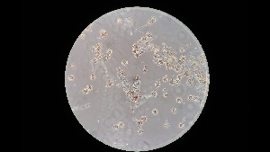  (Troposporella fumosa - GAJ.16720)  @11 [ ] by-nc (2023) Matti Kulju University of Oulu
