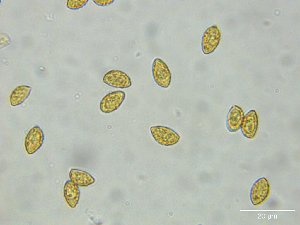  ( - FDS-CA-00355)  @11 [ ] by-nc (2024) Christian Schwarz Fungal Diversity Survey