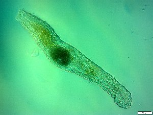  (Gastrotricha_class_incertae_sedis - AMU2.3)  @11 [ ] Copyright (2014) Malgorzata Kolicka Department of Animal Taxonomy and Ecology; Adam Mickiewicz University, Poznan