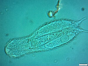  ( - AMU217.7)  @11 [ ] Copyright (2014) Malgorzata Kolicka Department of Animal Taxonomy and Ecology; Adam Mickiewicz University, Poznan