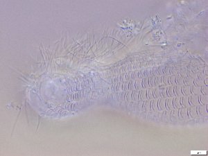  (Leidodermella - GA_10.9)  @11 [ ] Copyright (2016) Malgorzata Kolicka Department of Animal Taxonomy and Ecology; Adam Mickiewicz University, Poznan