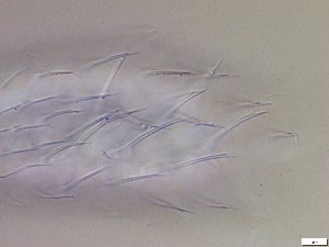  (Chaetonotus persimilis - GA_12.14)  @11 [ ] Copyright (2016) Malgorzata Kolicka Department of Animal Taxonomy and Ecology; Adam Mickiewicz University, Poznan