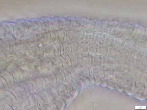 (Lepidodermella polaris - GA_15.5)  @11 [ ] Copyright (2016) Malgorzata Kolicka Department of Animal Taxonomy and Ecology; Adam Mickiewicz University, Poznan