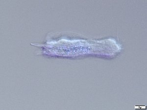  (Ichthydium - GA_5.2)  @11 [ ] Copyright (2016) Malgorzata Kolicka Department of Animal Taxonomy and Ecology; Adam Mickiewicz University, Poznan