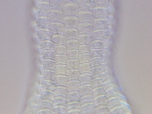  ( - HA_22.15)  @11 [ ] CreativeCommons  Attribution Non-Commercial (2016) Malgorzata Kolicka Department of Animal Taxonomy and Ecology Adam Mickiewicz University Poznan