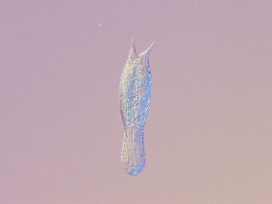  (Lepidodermella cf. polaris - HA_16.8)  @11 [ ] CreativeCommons  Attribution Non-Commercial (2016) Malgorzata Kolicka Department of Animal Taxonomy and Ecology Adam Mickiewicz University Poznan