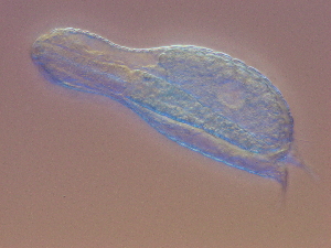  (Lepidodermella aff. squamata - HA_21.2)  @11 [ ] CreativeCommons  Attribution Non-Commercial (2016) Malgorzata Kolicka Department of Animal Taxonomy and Ecology Adam Mickiewicz University Poznan