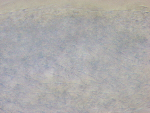  ( - HA_22.38)  @11 [ ] CreativeCommons  Attribution Non-Commercial (2016) Malgorzata Kolicka Department of Animal Taxonomy and Ecology Adam Mickiewicz University Poznan