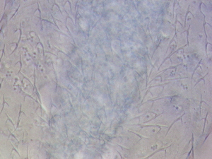  ( - HA_23.11)  @11 [ ] CreativeCommons  Attribution Non-Commercial (2016) Malgorzata Kolicka Department of Animal Taxonomy and Ecology Adam Mickiewicz University Poznan