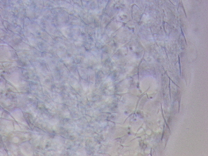  ( - HA_23.11)  @11 [ ] CreativeCommons  Attribution Non-Commercial (2016) Malgorzata Kolicka Department of Animal Taxonomy and Ecology Adam Mickiewicz University Poznan