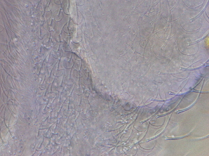  (Chaetonotus - HA_24.148)  @11 [ ] CreativeCommons  Attribution Non-Commercial (2016) Malgorzata Kolicka Department of Animal Taxonomy and Ecology Adam Mickiewicz University Poznan