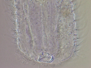  (Chaetonotus - HA_24.148)  @11 [ ] CreativeCommons  Attribution Non-Commercial (2016) Malgorzata Kolicka Department of Animal Taxonomy and Ecology Adam Mickiewicz University Poznan