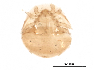  (Scutacarus - BIOUG23546-D02)  @13 [ ] CreativeCommons - Attribution (2015) CBG Photography Group Centre for Biodiversity Genomics
