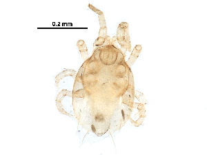  (Amblyseius sp. JCS07 - BIOUG25070-D10)  @13 [ ] CreativeCommons - Attribution (2016) CBG Photography Group Centre for Biodiversity Genomics