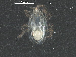  (Amblyseius perditus - BIOUG25070-F01)  @13 [ ] CreativeCommons - Attribution (2016) CBG Photography Group Centre for Biodiversity Genomics