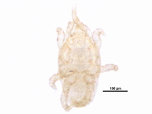  (Proctolaelaps sp. JCS63 - BIOUG33413-D02)  @11 [ ] CreativeCommons - Attribution (2017) CBG Photography Group Centre for Biodiversity Genomics