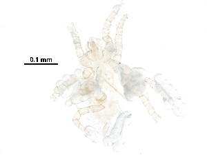  (Dicrocheles sp. JCS02 - BIOUG26836-C11)  @13 [ ] CreativeCommons - Attribution (2016) CBG Photography Group Centre for Biodiversity Genomics