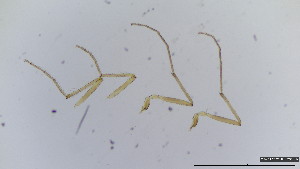  (Eukiefferiella lobifera - HKU29)  @11 [ ] Copyright (2025) Mathew Stephen Seymour The University of Hong Kong
