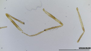  (Polypedilum sp.HK4 - HKU30)  @11 [ ] Copyright (2025) Mathew Stephen Seymour The University of Hong Kong