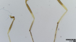  (Polypedilum nudiprostatum - HKU55)  @11 [ ] Copyright (2025) Mathew Stephen Seymour The University of Hong Kong
