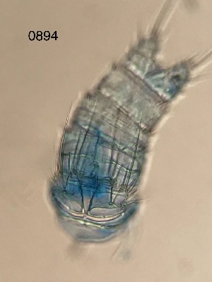  (Mesochra cf. lilljeborgii - 0894.1)  @11 [ ] Creative Commons BY NC SA (2022) University of Bergen Natural History Collections