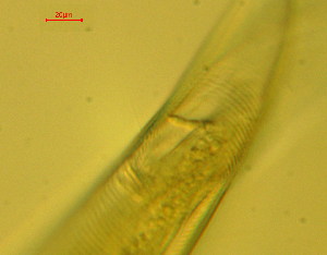  (Parasphaerolaimus paradoxus - OUCDZ30A)  @11 [ ] CreativeCommons - Attribution Non-Commercial Share-Alike (2016) Hong Zhou Ocean University of China