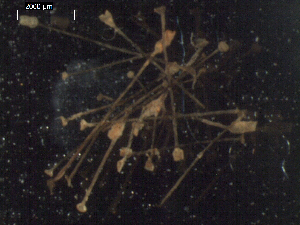  (unclassified Semaeostomeae - I15_224)  @11 [ ] Copyright © (2025) Terue Cristina Kihara German Center for Marine Biodiversity Research