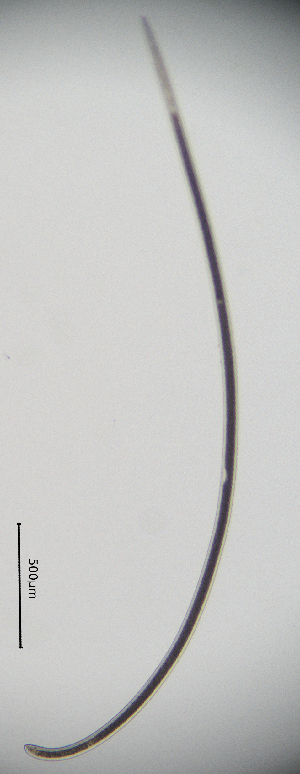  (Longidorinae - BGE_00645_B02)  @11 [ ] CreativeCommons - Attribution Share - Alike (2025) Unspecified Unspecified