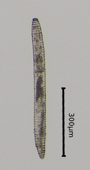  (Criconema annuliferum - BGE_00645_C01)  @11 [ ] CreativeCommons - Attribution Share - Alike (2025) Unspecified Unspecified