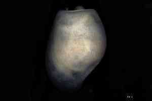  ( - ZMBN_160777)  @11 [ ] Creative Commons BY NC SA (2025) University of Bergen Natural History Collections