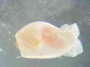  ( - ZMBN_160777)  @11 [ ] Creative Commons BY NC SA (2025) University of Bergen Natural History Collections