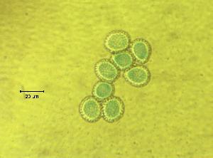  ( - 00S1)  @11 [ ] Copyright (2009) Richard Hamelin Laboratory Natural Resources Canada