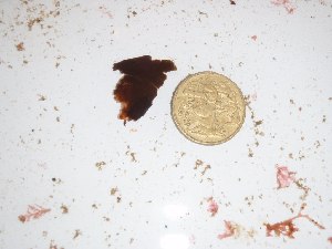 (Ramipedicella - GWS027381)  @11 [ ] Unspecified (default): All Rights Reserved  Unspecified Unspecified