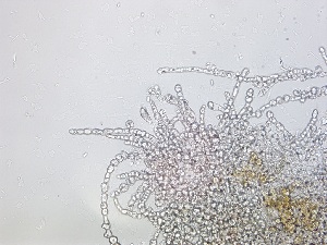  (Hecatonema sp. 1maculans - GWS032446)  @11 [ ] Unspecified (default): All Rights Reserved  Unspecified Unspecified